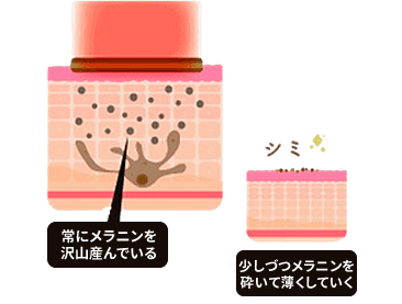 ハリウッドトーニング｜肝斑や色素沈着、肌のくすみなどにアプローチする美容治療